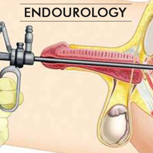 Endourology